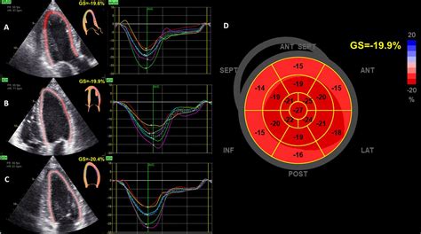 lv global longitudinal strain
